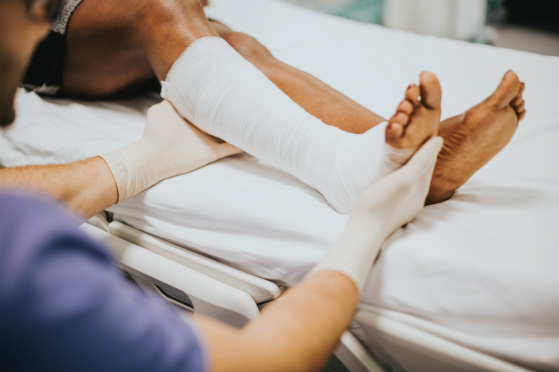 How did You Break Your Leg?