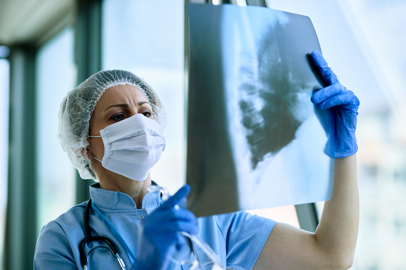 NTU Tuberculosis Case Leads to Large-Scale Contact Tracing
